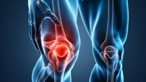 Back of knee pain when bending - causes and treatment options