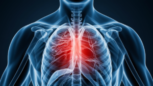 Chest pain after eating - causes and treatment options