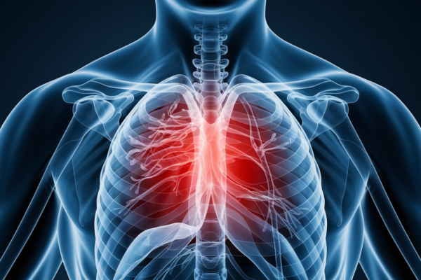 Chest pain after eating - causes and treatment options