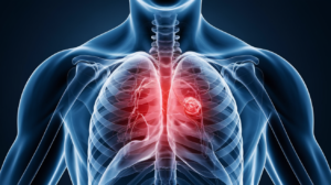 Chest pain pregnancy - causes and treatment options