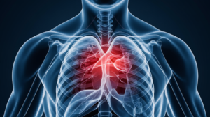 Chest pain when lying down - causes and treatment options