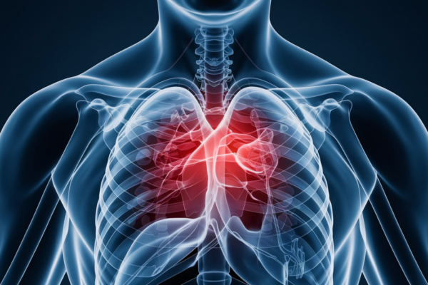 Chest pain when lying down - causes and treatment options