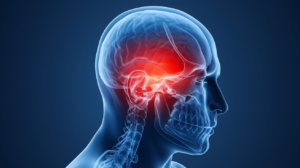 Pain in head when you cough, sneeze or bendover - causes and treatment options