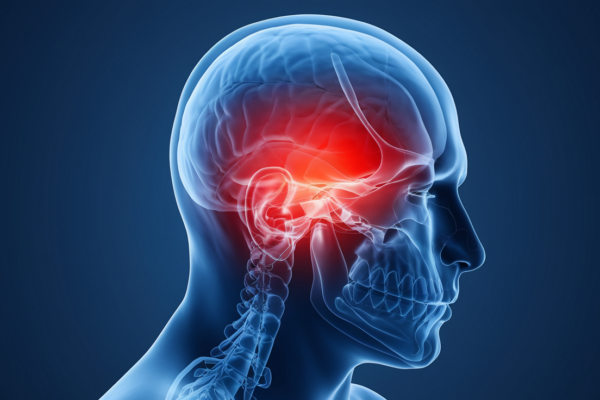 Pain in head when you cough, sneeze or bendover - causes and treatment options