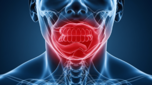 Pain in throat - causes and treatment options