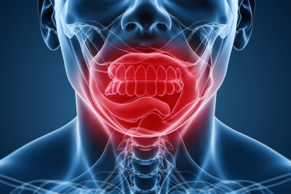 Pain in throat - causes and treatment options
