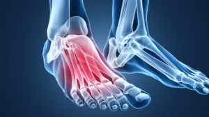Pain on top of foot - causes and treatment options