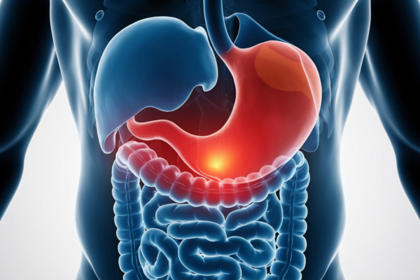 Stomach pain after eating - causes and treatment options